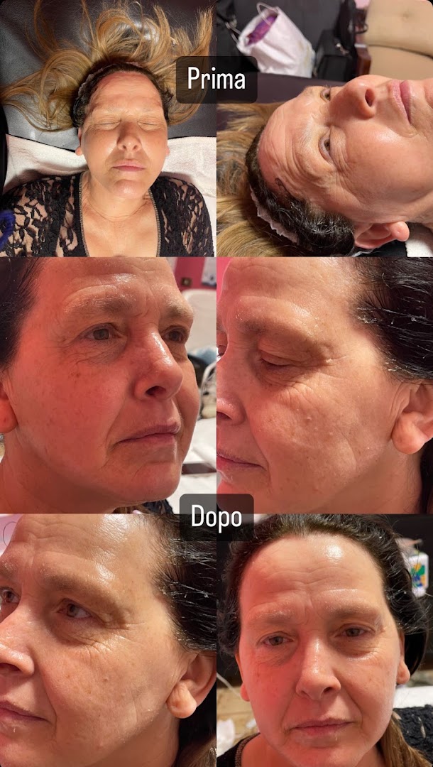 massaggi e trattamenti carla · Foto 7